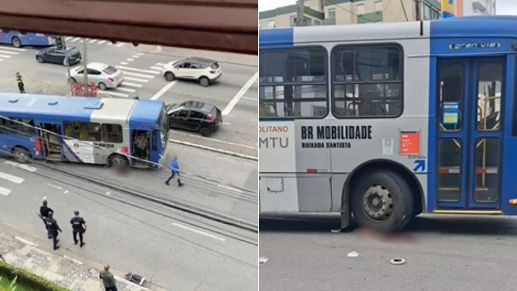 Atropelamento com ônibus deixa idosa de 79 anos com amputação traumática em São Vicente