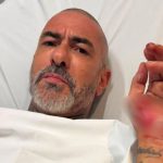 Jurado do MasterChefe relata acidente de moto e sumiço de aliança em hospital