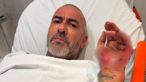 Fogaça, jurado do MasterChef, aparece em um hospital com expressão séria, sentado sobre um leito, fazendo um gesto com a mão enquanto relata um acidente de moto.