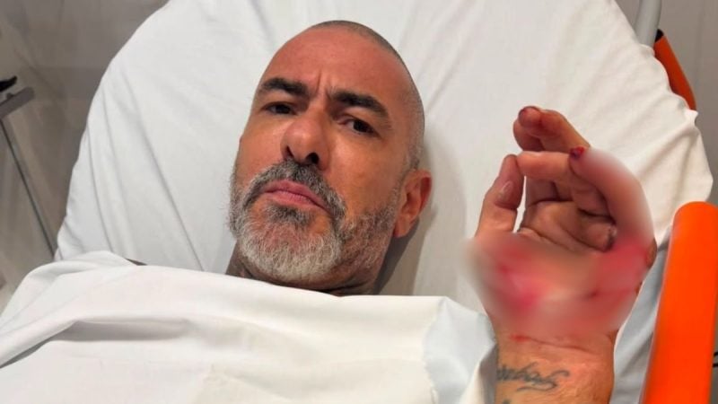 Fogaça, jurado do MasterChef, aparece em um hospital com expressão séria, sentado sobre um leito, fazendo um gesto com a mão enquanto relata um acidente de moto.