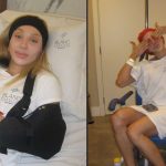 Maya Massafera faz cirurgia para reduzir largura dos ombros e perde 4 cm