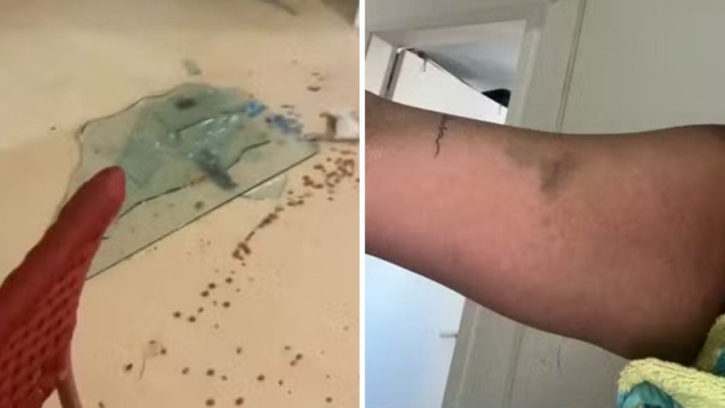 Imagem mostra danos em residência e marcas no corpo atribuídos a violência: quadro com marcas e perfurações na parede e um braço com hematoma exibido no contexto do caso Cartolouco. Reprodução/TV Globo.