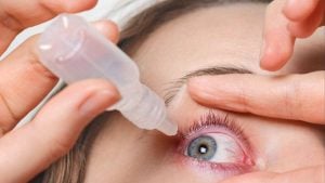 Pessoa aplicando colírio em um olho, com um conta-gotas encostado na pálpebra e mão segurando o frasco; imagem de cuidados oftalmológicos e saúde ocular.