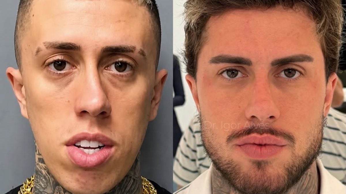 Antes e depois do MC Daniel
