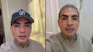 MC Guimê faz harmonização facial em comparação antes e depois: à esquerda jovem com tatoos e boné, à direita homem com expressão sorridente em ambiente interno, com mensagem “O pai ficou mais bonito”.