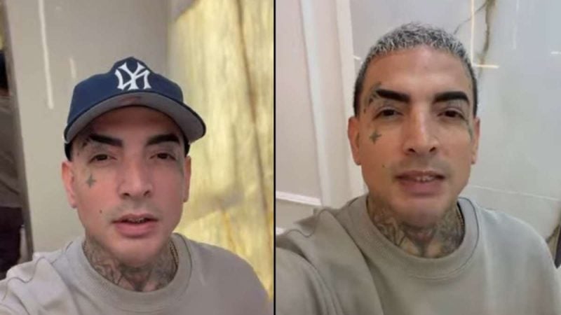 MC Guimê faz harmonização facial em comparação antes e depois: à esquerda jovem com tatoos e boné, à direita homem com expressão sorridente em ambiente interno, com mensagem “O pai ficou mais bonito”.