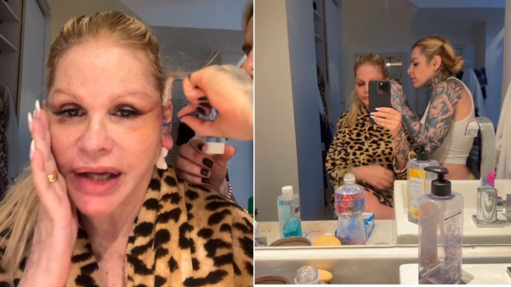 Monique Evans relata perrengue após cirurgia no rosto: ela aparece em selfie no espelho, com expressão de surpresa, usando estampa de oncinha, em ambiente de banheiro.