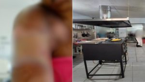 acidente de trabalho em restaurante de Santos: cena em cozinha industrial com fogão e equipamentos, reforçando o contexto de queimadura por óleo quente e condenação do estabelecimento