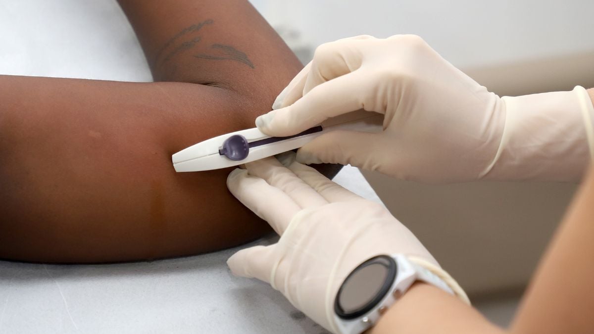 Implantes anticoncepcionais Campinas: profissional de saúde prepara seringa com implante e aplica o anticoncepcional sob a pele, destacando adesão na rede pública.