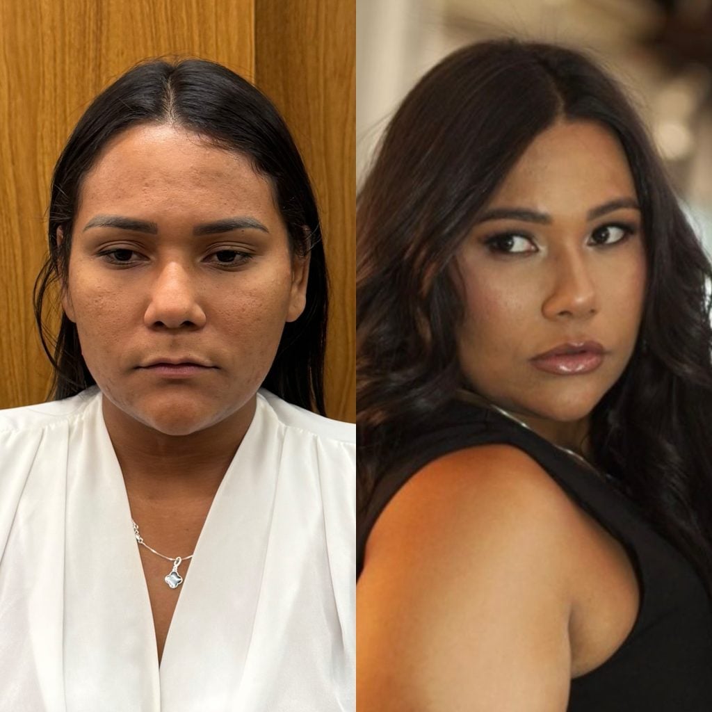 Antes e depois de Chaiany. (Reprodução/redes sociais)