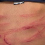 http://Padrasto%20é%20preso%20após%20menino%20de%2012%20anos%20buscar%20ajuda%20por%20agressões