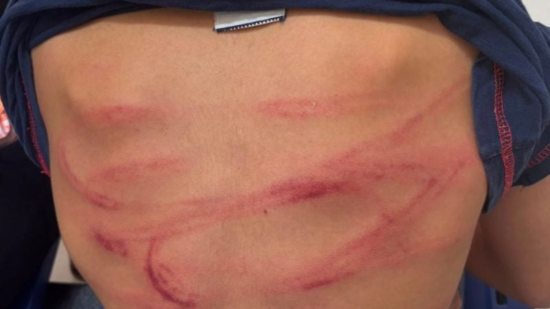 Menino é agredido pelo padrasto em Artur Nogueira