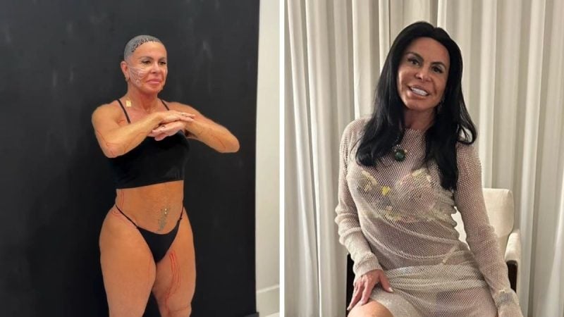 Gretchen em dois momentos: à esquerda, com roupa íntima em estúdio, mostrando o resultado de tratamento contra flacidez no rosto e no corpo; à direita, em ambiente interno, sorrindo. 'Ficando incrível'.