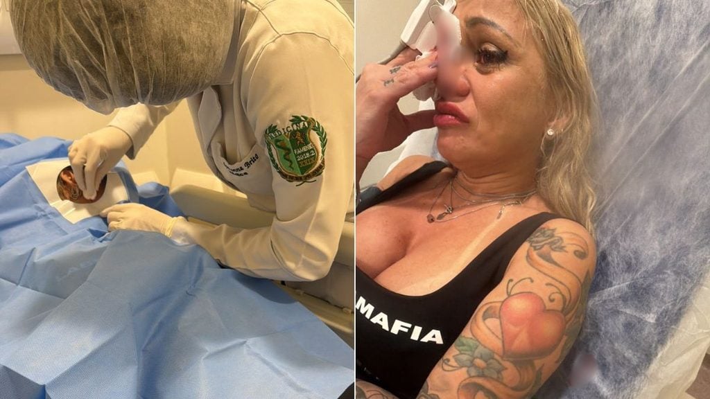 cabeleireira agredida em Praia Grande: Procedimento odontológico em consultório: profissional com luvas limpa o rosto e faz atendimento em paciente que está deitada, com sensação de cuidado e registro do caso. Foto: arquivo pessoal.