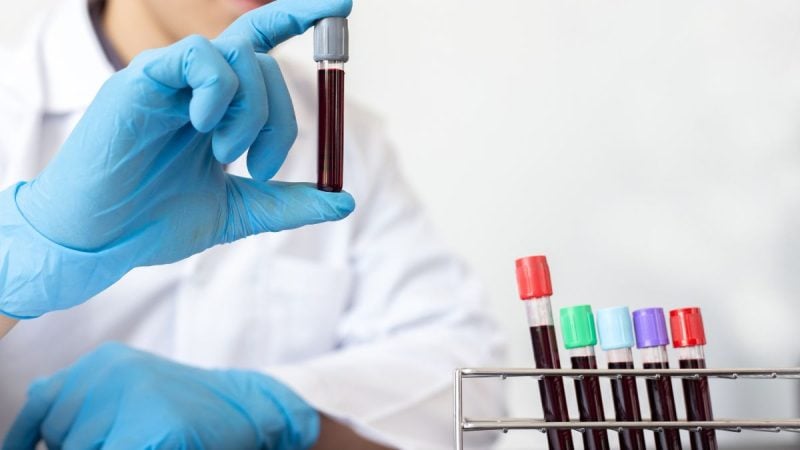 Médico com luvas azuis realiza coleta e análise de sangue com tubos de ensaio em laboratório, com foco em diagnóstico e detecção precoce de câncer de pâncreas.