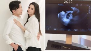 Imagem em composição: Pyong Lee e Natália Nasser em ensaio romântico de mãos dadas e, ao lado, ultrassom exibido em monitor de ecografia com a indicação “2027” no topo e aparelho ultrassom