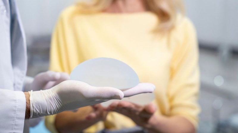 Médico em ambiente clínico apresenta um modelo de Prótese de silicone em formato de cápsula, explicando se precisa ser trocada após 10 anos.
