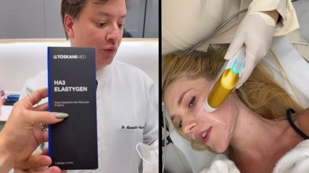 Homem mostra um frasco/embalagem do produto TOSKANIMED “HA3 ELASTYGEN”. Ao lado, Virginia faz procedimento estético com cânula no rosto e equipamento de aplicação na pele.